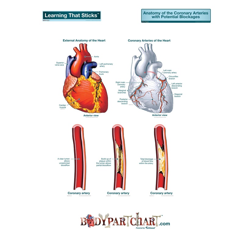 Body Part Chart:  Artery Blockages        –   Removable     Adhesive Decal