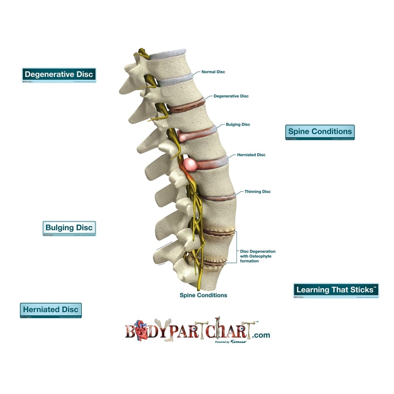 Body Part Chart:  Spine Conditions        –   Removable     Adhesive Decal